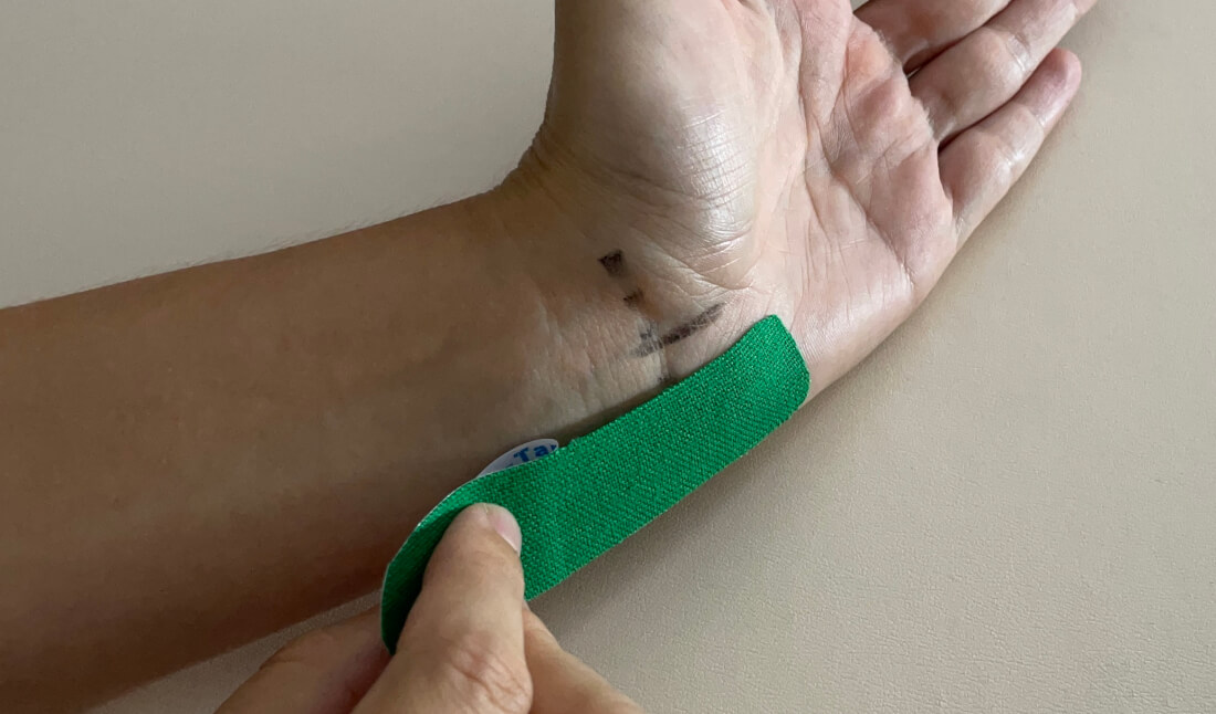 Kleiner Finger & Ringfinger taub! Was nun?