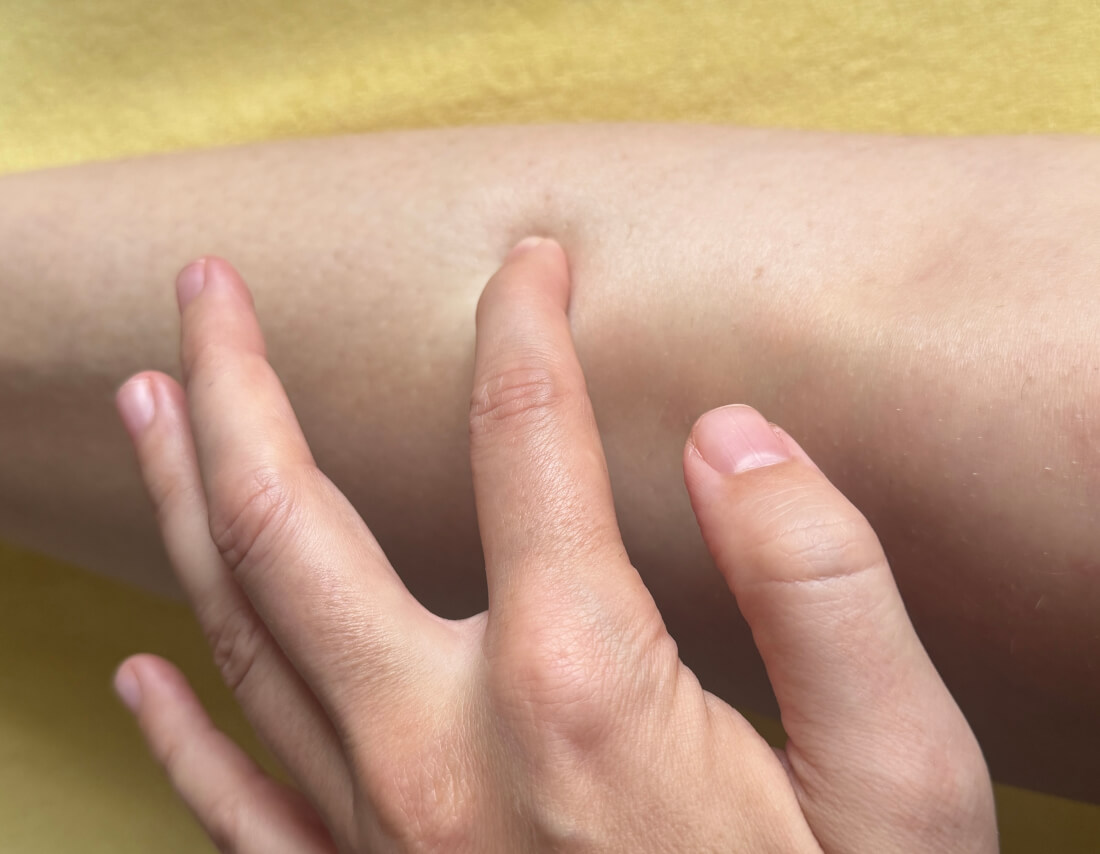 Müdigkeit & Erschöpfung - Einfacher Akupressurpunkt