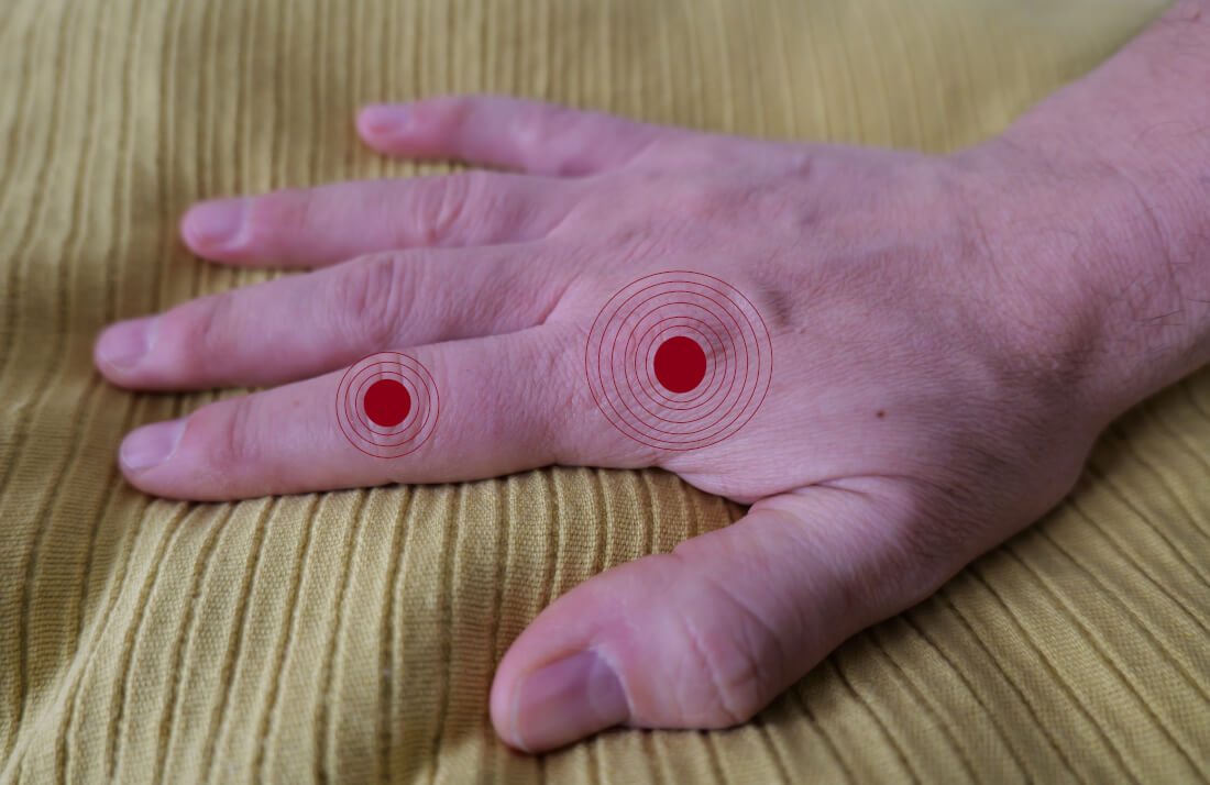 Rheumatoide Arthritis vs. Arthrose